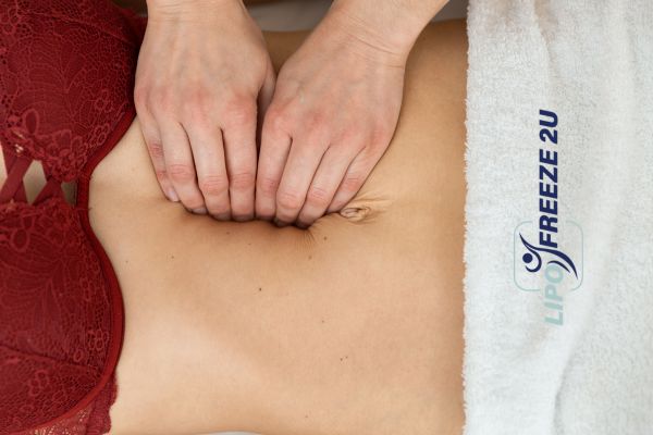 diastasis recti treatment Hatfield