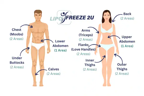Areas you can have fat freezing treatment Hatfield