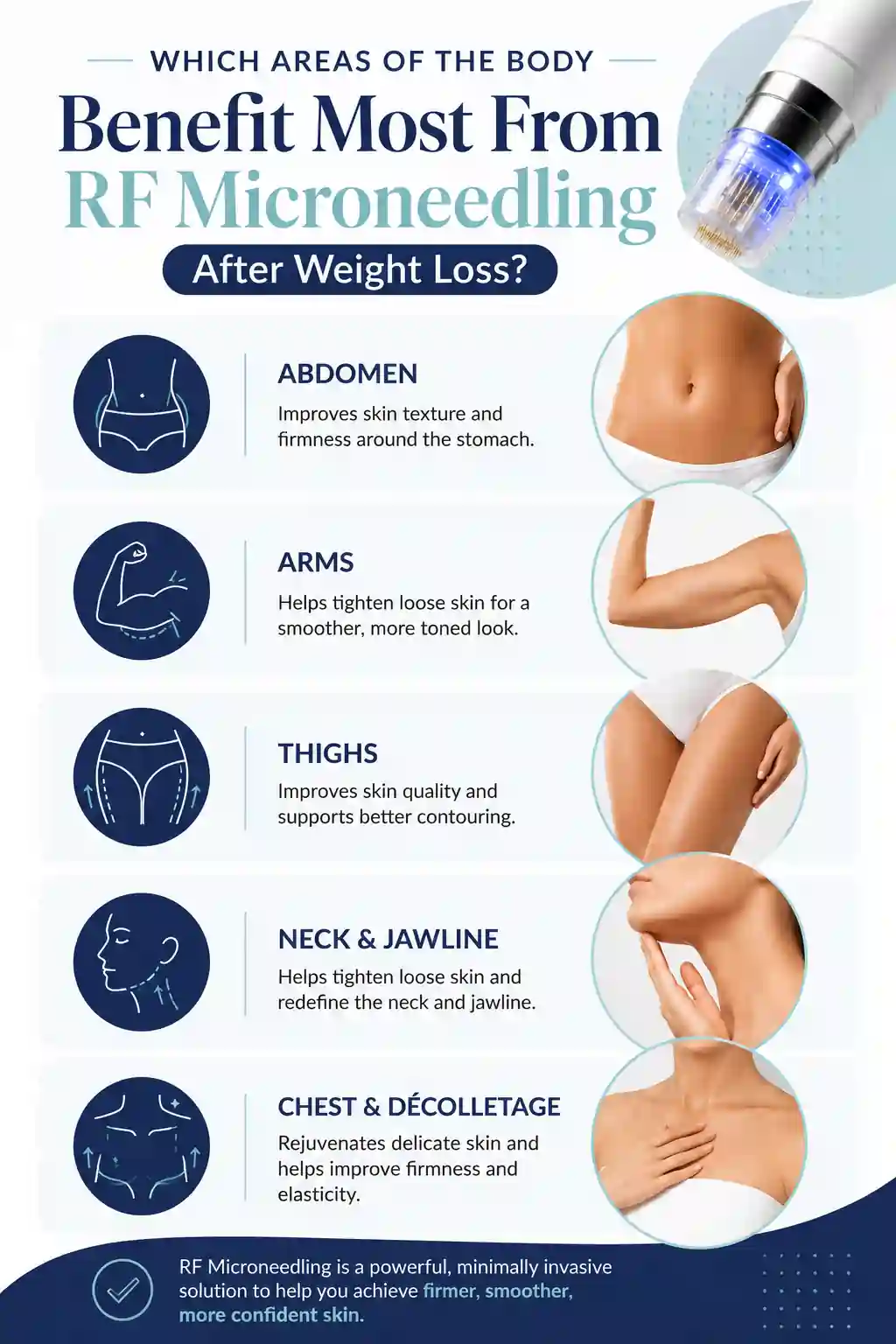 Which Areas of the Body Benefit Most From RF Microneedling After Weight Loss Hatfield